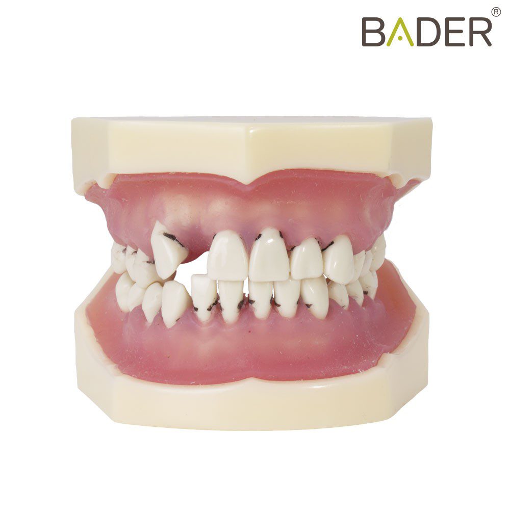 4056-Model-of-periodontics.jpg