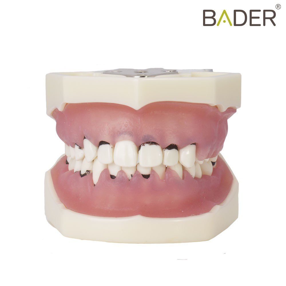 4057-PERIODONT-PERIODONCT-TIPODONT-WITH-ARTICULATOR-BADER.jpg
