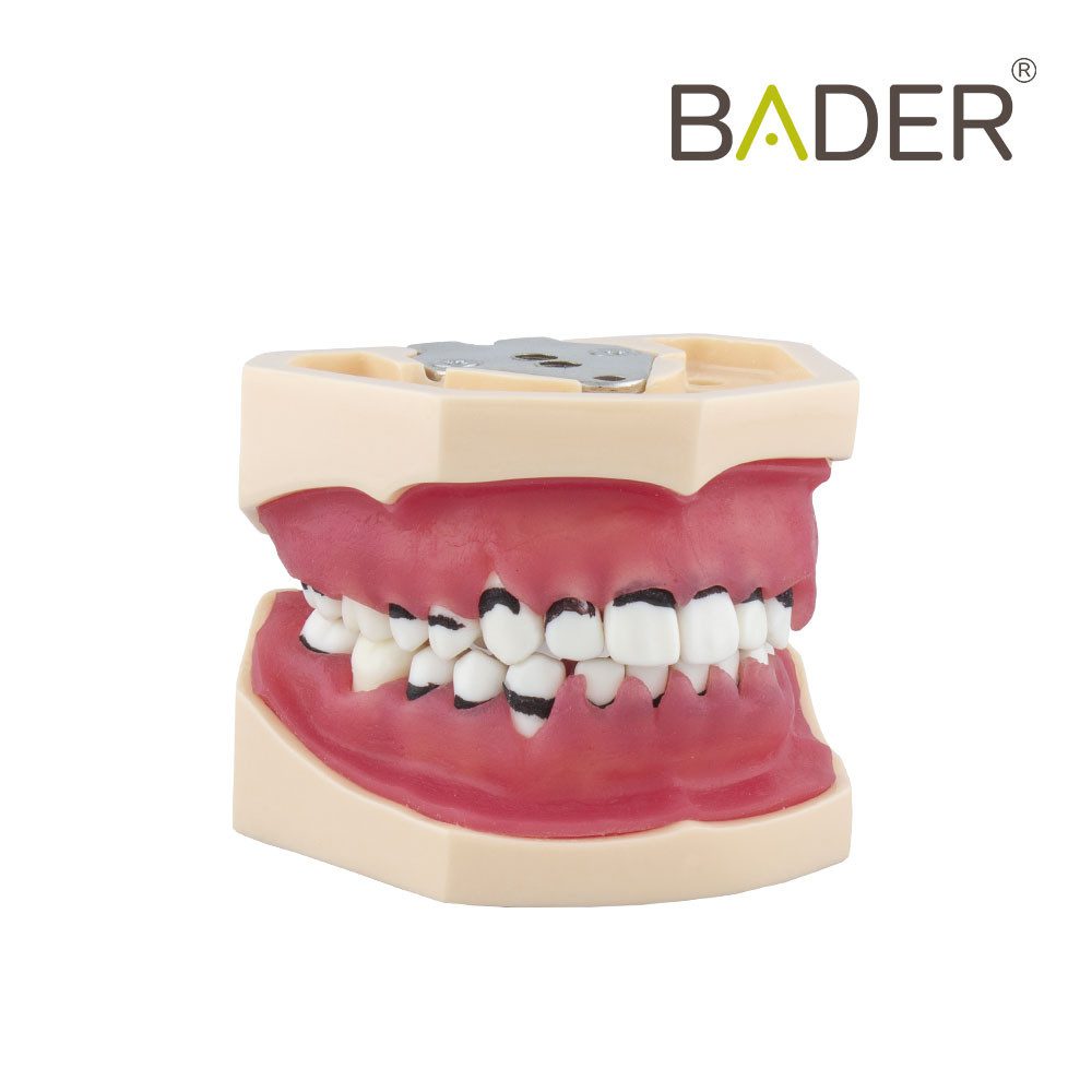 6828-TIPODONT-OF-PERIODONTICS-COMPLETO-BADER.jpg